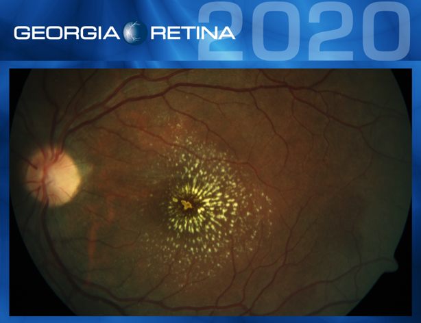 Example shot of the 2020 Georgia Retina calendar.