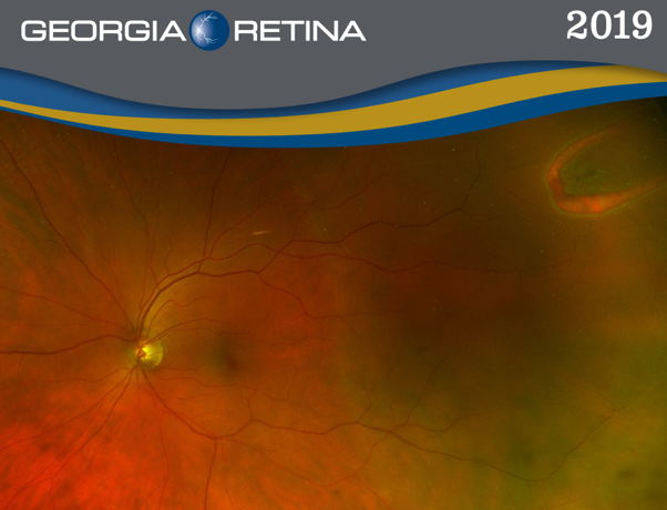 Example shot of the 2019 Georgia Retina calendar.